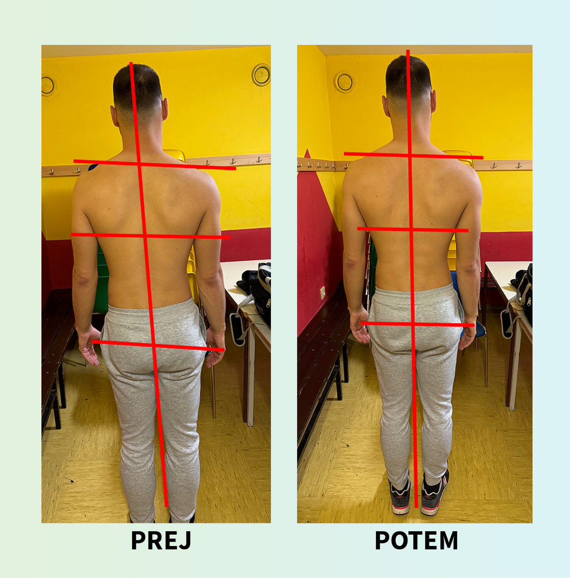 Korekcija drže — primer 1