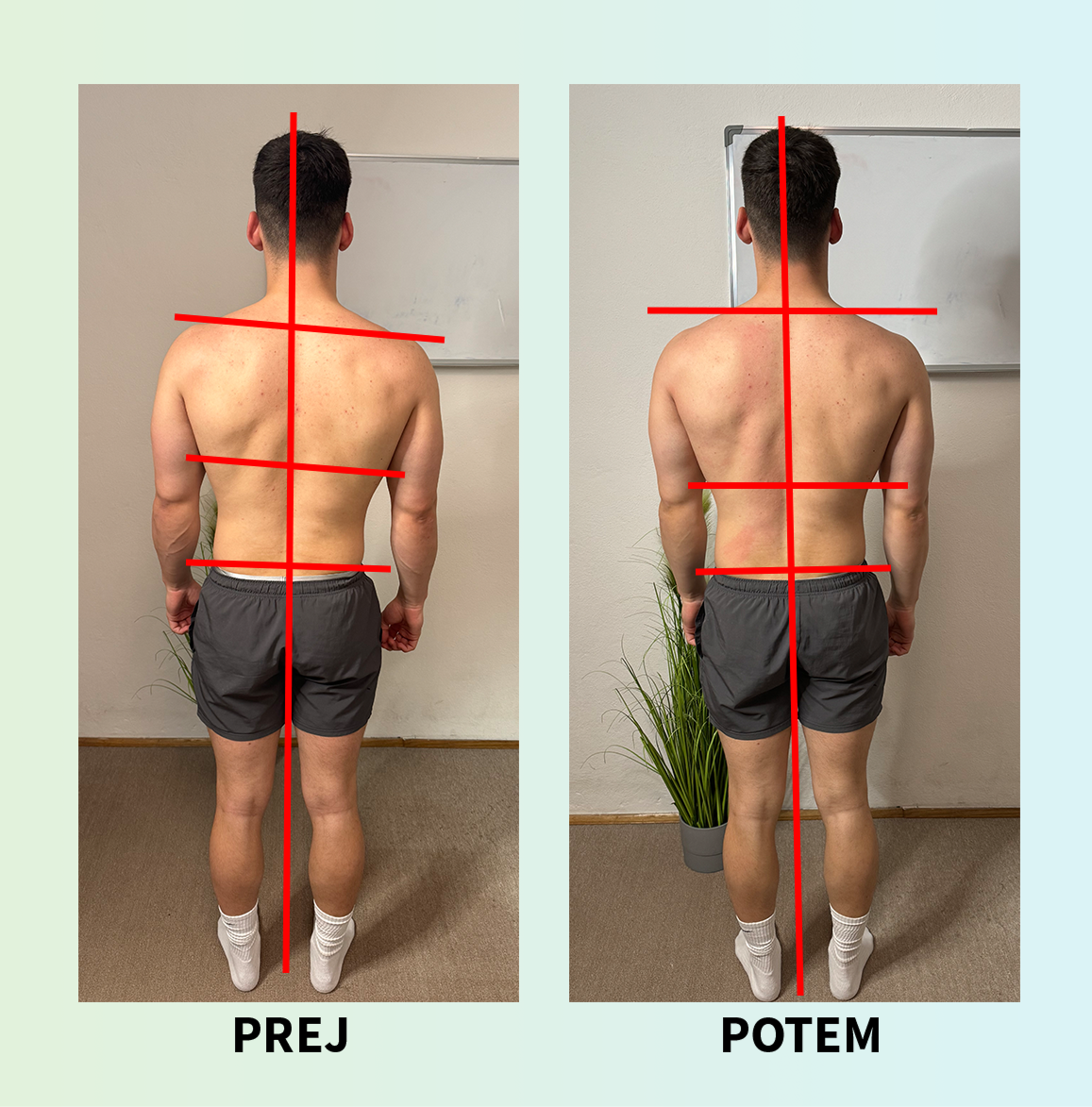 Korekcija drže — primer 2