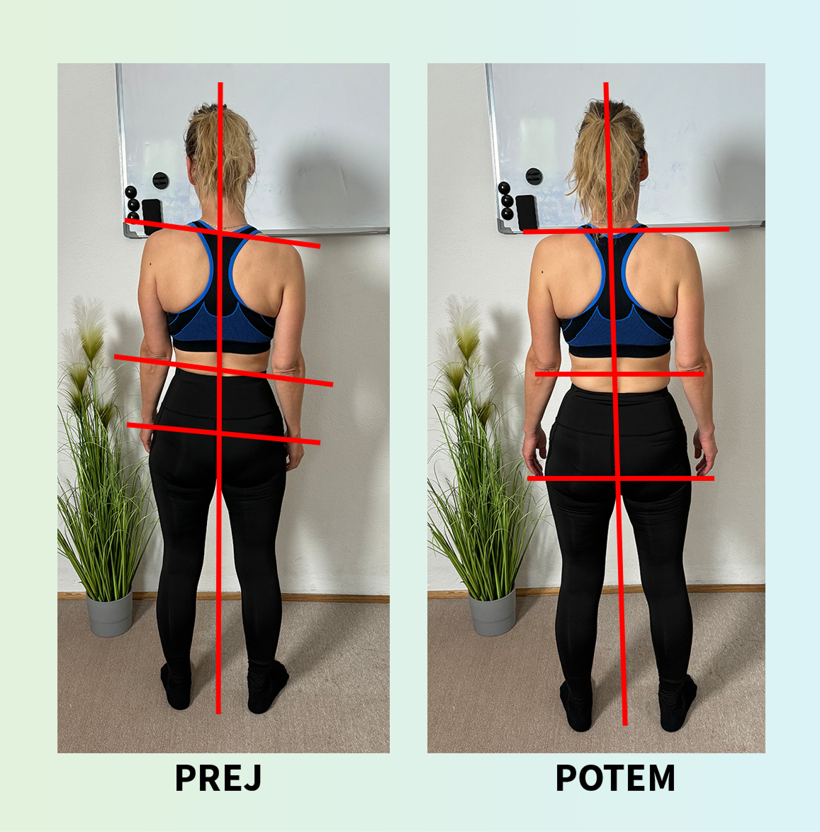 Korekcija drže — primer 3